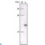 MER / MERTK Antibody - Western Blot (WB) analysis using MerTK Monoclonal Antibody against full-length MerTK recombinant protein.