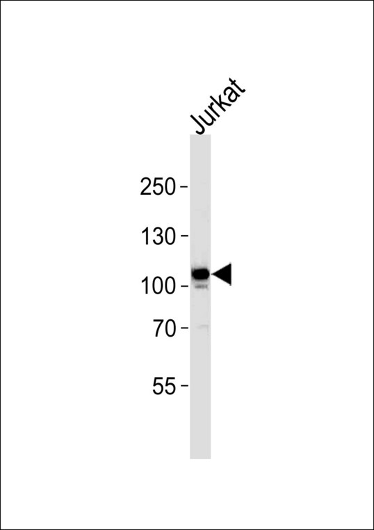 MER / MERTK Antibody - MER Antibody western blot of Jurkat cell line lysates (35 ug/lane). The MER antibody detected the MER protein (arrow).