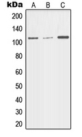 MER / MERTK Antibody - Western blot analysis of MERTK expression in HEK293T (A); Jurkat (B); U937 (C) whole cell lysates.