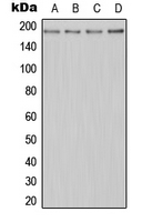 MER / MERTK Antibody - Western blot analysis of MERTK expression in Jurkat (A); HeLa (B); Raw264.7 (C); H9C2 (D) whole cell lysates.