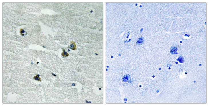 MER / MERTK Antibody - Immunohistochemistry analysis of paraffin-embedded human brain, using MER/SKY (Phospho-Tyr749/681) Antibody. The picture on the right is blocked with the phospho peptide.
