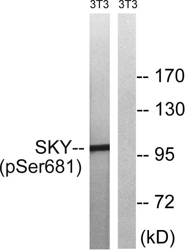 MER / MERTK Antibody - Western blot analysis of lysates from NIH/3T3 cells treated with EGF 200ng/ml 5', using MER/SKY (Phospho-Tyr749/681) Antibody. The lane on the right is blocked with the phospho peptide.