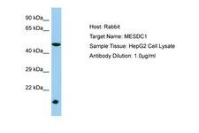 MESDC1 Antibody -  This image was taken for the unconjugated form of this product. Other forms have not been tested.