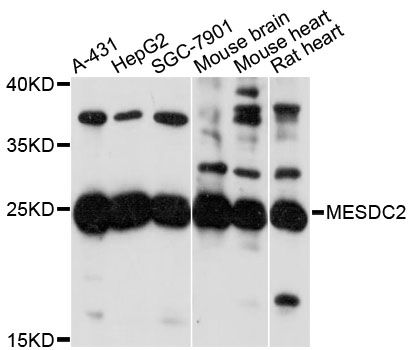 MESDC2 / MESD Antibody - Western blot analysis of extracts of various cell lines, using MESDC2 antibody at 1:3000 dilution. The secondary antibody used was an HRP Goat Anti-Rabbit IgG (H+L) at 1:10000 dilution. Lysates were loaded 25ug per lane and 3% nonfat dry milk in TBST was used for blocking. An ECL Kit was used for detection and the exposure time was 60s.