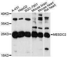 MESDC2 / MESD Antibody - Western blot analysis of extracts of various cell lines, using MESDC2 antibody at 1:3000 dilution. The secondary antibody used was an HRP Goat Anti-Rabbit IgG (H+L) at 1:10000 dilution. Lysates were loaded 25ug per lane and 3% nonfat dry milk in TBST was used for blocking. An ECL Kit was used for detection and the exposure time was 60s.