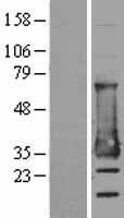 MESDC2 / MESD Protein - Western validation with an anti-DDK antibody * L: Control HEK293 lysate R: Over-expression lysate