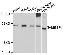 MESP1 Antibody - Western blot analysis of extracts of various cell lines, using MESP1 antibody at 1:1000 dilution. The secondary antibody used was an HRP Goat Anti-Rabbit IgG (H+L) at 1:10000 dilution. Lysates were loaded 25ug per lane and 3% nonfat dry milk in TBST was used for blocking. An ECL Kit was used for detection and the exposure time was 60s.