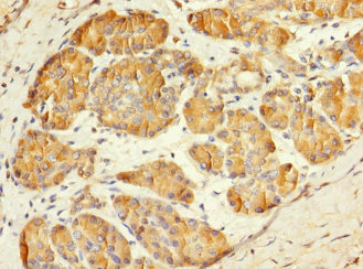 MESP1 Antibody - Immunohistochemistry of paraffin-embedded human pancreatic tissue at dilution 1:100