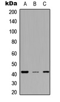 MESP2 Antibody - Western blot analysis of MESP2 expression in A549 (A); NS-1 (B); H9C2 (C) whole cell lysates.