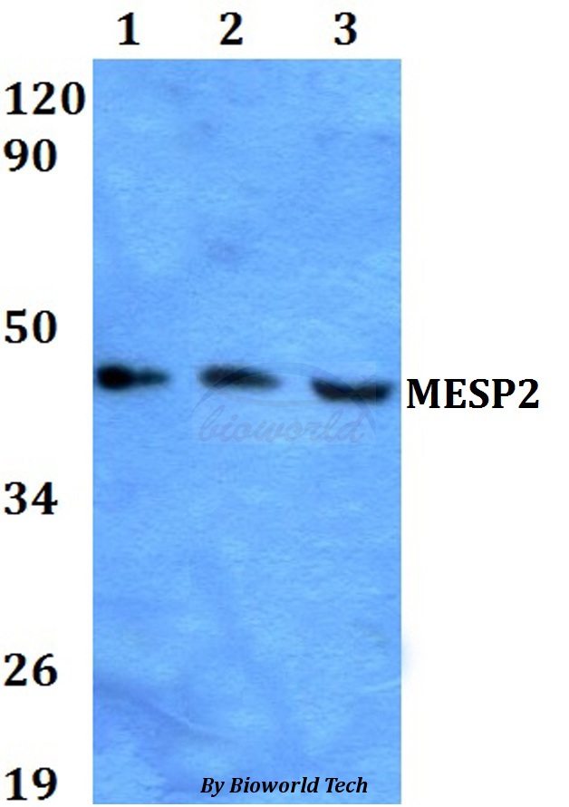 MESP2 Antibody - Western blot of MESP2 antibody at 1:500 dilution. Lane 1: A549 whole cell lysate. Lane 2: sp2/0 whole cell lysate. Lane 3: H9C2 whole cell lysate.