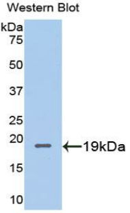 Metallothionein 2 Antibody - Western blot of recombinant MT2A / Metallothionein 2A.  This image was taken for the unconjugated form of this product. Other forms have not been tested.