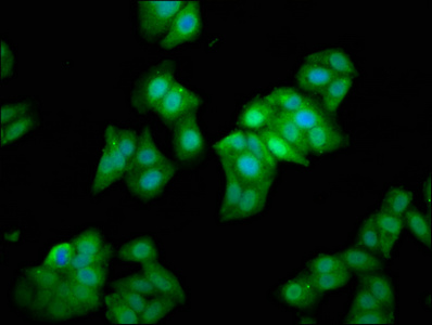 METAP1 Antibody - Immunofluorescence staining of HepG2 cells at a dilution of 1:133, counter-stained with DAPI. The cells were fixed in 4% formaldehyde, permeabilized using 0.2% Triton X-100 and blocked in 10% normal Goat Serum. The cells were then incubated with the antibody overnight at 4°C.The secondary antibody was Alexa Fluor 488-congugated AffiniPure Goat Anti-Rabbit IgG (H+L) .