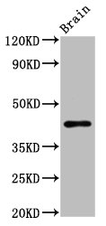 METAP1 Antibody - Positive Western Blot detected in Rat brain tissue. All lanes: METAP1 antibody at 6.2 µg/ml Secondary Goat polyclonal to rabbit IgG at 1/50000 dilution. Predicted band size: 44 KDa. Observed band size: 44 KDa