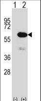 METAP2 Antibody - Western blot of METAP2 (arrow) using rabbit polyclonal METAP2 Antibody. 293 cell lysates (2 ug/lane) either nontransfected (Lane 1) or transiently transfected (Lane 2) with the METAP2 gene.