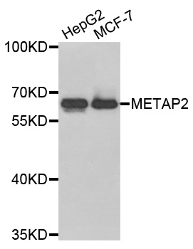 METAP2 Antibody - Western blot analysis of extracts of various cell lines.