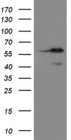 METAP2 Antibody - HEK293T cells were transfected with the pCMV6-ENTRY control (Left lane) or pCMV6-ENTRY METAP2 (Right lane) cDNA for 48 hrs and lysed. Equivalent amounts of cell lysates (5 ug per lane) were separated by SDS-PAGE and immunoblotted with anti-METAP2.