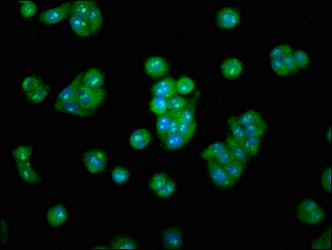 METAP2 Antibody - Immunofluorescence staining of HepG2 cells at a dilution of 1:100, counter-stained with DAPI. The cells were fixed in 4% formaldehyde, permeabilized using 0.2% Triton X-100 and blocked in 10% normal Goat Serum. The cells were then incubated with the antibody overnight at 4 °C.The secondary antibody was Alexa Fluor 488-congugated AffiniPure Goat Anti-Rabbit IgG (H+L) .