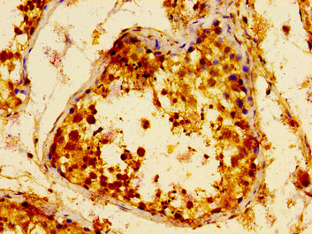 METAP2 Antibody - Immunohistochemistry image at a dilution of 1:100 and staining in paraffin-embedded human testis tissue performed on a Leica BondTM system. After dewaxing and hydration, antigen retrieval was mediated by high pressure in a citrate buffer (pH 6.0) . Section was blocked with 10% normal goat serum 30min at RT. Then primary antibody (1% BSA) was incubated at 4 °C overnight. The primary is detected by a biotinylated secondary antibody and visualized using an HRP conjugated SP system.