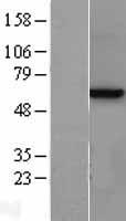 METAP2 Protein - Western validation with an anti-DDK antibody * L: Control HEK293 lysate R: Over-expression lysate