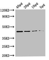 metC Antibody - Western Blot Positive WB detected in: Rosseta bacteria lysate at 40µg, 20µg, 10µg, 5µg All lanes: metC antibody at 0.36µg/ml Secondary Goat polyclonal to rabbit IgG at 1/50000 dilution Predicted band size: 44 kDa Observed band size: 44 kDa