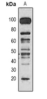 Methyl-Lysine Antibody - Western blot analysis of Methyl Lysine expression in HeLa (A) whole cell lysates.