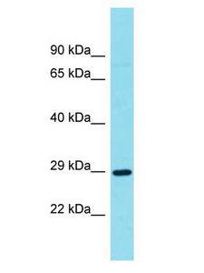 METRNL Antibody - METRNL antibody Western Blot of OVCAR-3. Antibody dilution: 1 ug/ml.  This image was taken for the unconjugated form of this product. Other forms have not been tested.