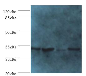 METRNL Antibody - Western blot. All lanes: Meteorin-like protein antibody at 2 ug/ml. Lane 1:mouse small intestine tissue. Lane 2: mouse kidney tissue Lane 3: rat gonad tissue Lane 4: mouse brain tissue. Secondary antibody: Goat polyclonal to rabbit at 1:10000 dilution.  This image was taken for the unconjugated form of this product. Other forms have not been tested.
