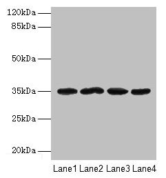 METRNL Antibody - Western blot All lanes: Meteorin-like protein antibody at 2µg/ml Lane 1: Mouse small intestine tissue Lane 2: Mouse kidney tissue Lane 3: Rat gonad tissue Lane 4: Mouse brain tissue Secondary Goat polyclonal to rabbit IgG at 1/10000 dilution Predicted band size: 35, 26 kDa Observed band size: 35 kDa