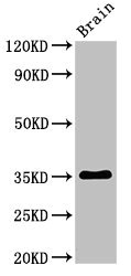 METRNL Antibody - Western Blot Positive WB detected in:Rat brain tissue All Lanes:Metrnl antibody at 3µg/ml Secondary Goat polyclonal to rabbit IgG at 1/50000 dilution Predicted band size: 35,36 KDa Observed band size: 35 KDa
