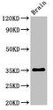 METRNL Antibody - Western Blot Positive WB detected in:Rat brain tissue All Lanes:Metrnl antibody at 3µg/ml Secondary Goat polyclonal to rabbit IgG at 1/50000 dilution Predicted band size: 35,36 KDa Observed band size: 35 KDa