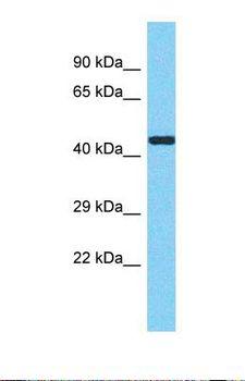 METT11D1 Antibody - Western blot of Human HCT15. METTL17 antibody dilution 1.0 ug/ml.  This image was taken for the unconjugated form of this product. Other forms have not been tested.