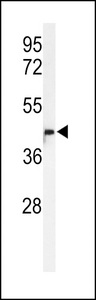 METT11D1 Antibody - Western blot of M11D1 Antibody in HL-60 cell line lysates (35 ug/lane). M11D1 (arrow) was detected using the purified antibody.
