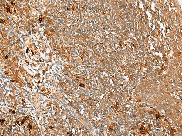 METT11D1 Antibody - Immunohistochemistry of paraffin-embedded Human tonsil tissue  using METTL17 Polyclonal Antibody at dilution of 1:60(×200)