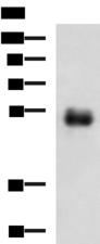 METT11D1 Antibody - Western blot analysis of Human colorectal cancer tissue lysate  using METTL17 Polyclonal Antibody at dilution of 1:700