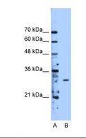 METTL1 Antibody - Lane A: Marker. Lane B: HepG2 cell lysate. Antibody concentration: 2.5 ug/ml. Gel concentration: 12%.  This image was taken for the unconjugated form of this product. Other forms have not been tested.