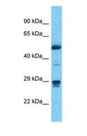 METTL1 Antibody - Western blot of METTL1 Antibody with Stomach Tumor lysate.  This image was taken for the unconjugated form of this product. Other forms have not been tested.