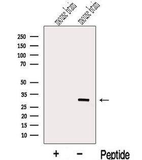 METTL1 Antibody - Western blot analysis of extracts of mouse brain tissue using METTL1 antibody. The lane on the left was treated with blocking peptide.