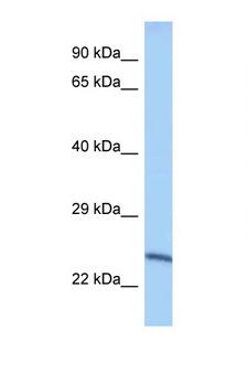 METTL10 Antibody - METTL10 antibody Western blot of Mouse Spleen lysate. Antibody concentration 1 ug/ml.  This image was taken for the unconjugated form of this product. Other forms have not been tested.