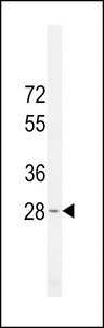 METTL10 Antibody - METTL10 Antibody western blot of HL-60 cell line lysates (35 ug/lane). The METTL10 antibody detected the METTL10 protein (arrow).