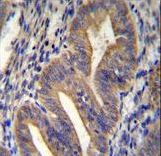 METTL10 Antibody - METTL10 Antibody immunohistochemistry of formalin-fixed and paraffin-embedded human uterus tissue followed by peroxidase-conjugated secondary antibody and DAB staining.