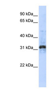 METTL10 Antibody - METTL10 antibody Western blot of Transfected 293T cell lysate. This image was taken for the unconjugated form of this product. Other forms have not been tested.