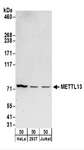 METTL13 / KIAA0859 Antibody - Detection of Human METTL13 by Western Blot. Samples: Whole cell lysate (50 ug) from HeLa, 293T, and Jurkat cells. Antibodies: Affinity purified rabbit anti-METTL13 antibody used for WB at 0.4 ug/ml. Detection: Chemiluminescence with an exposure time of 3 minutes.