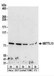 METTL13 / KIAA0859 Antibody - Detection of Human and Mouse METTL13 by Western Blot. Samples: Whole cell lysate (50 ug) from HeLa, 293T, Jurkat, mouse TCMK-1, and mouse NIH3T3 cells. Antibodies: Affinity purified rabbit anti-METTL13 antibody used for WB at 1 ug/ml. Detection: Chemiluminescence with an exposure time of 3 minutes.