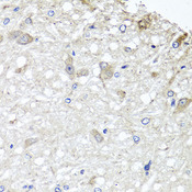 METTL13 / KIAA0859 Antibody - Immunohistochemistry of paraffin-embedded rat brain tissue.