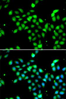 METTL13 / KIAA0859 Antibody - Immunofluorescence analysis of A549 cells using METTL13 antibody. Blue: DAPI for nuclear staining.