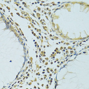 METTL13 / KIAA0859 Antibody - Immunohistochemistry of paraffin-embedded human colon using METTL13 antibody at dilution of 1:100 (40x lens).