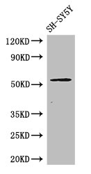METTL14 Antibody - Positive WB detected in:SH-SY5Y whole cell lysate;All lanes: METTL14 antibody at 3ug/ml;Secondary;Goat polyclonal to rabbit IgG at 1/50000 dilution;Predicted band size: 53 kDa;Observed band size: 53 kDa;