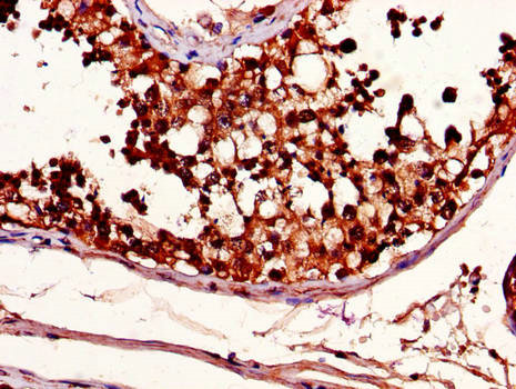 METTL14 Antibody - Immunohistochemistry of paraffin-embedded human testis tissue using METTL14 Antibody at dilution of 1:100