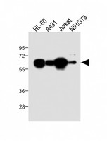 METTL14 Antibody - All lanes: Anti-METTL14 Antibody (N-Term) at 1:2000 dilution Lane 1: HL-60 whole cell lysate Lane 2: A431 whole cell lysate Lane 3: Jurkat whole cell lysate Lane 4: NIH/3T3 whole cell lysate Lysates/proteins at 20 µg per lane. Secondary Goat Anti-Rabbit IgG, (H+L), Peroxidase conjugated at 1/10000 dilution. Predicted band size: 52 kDa Blocking/Dilution buffer: 5% NFDM/TBST.