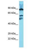 METTL16 / METT10D Antibody - METTL16 / METT10D antibody Western Blot of Esophagus Tumor. Antibody dilution: 1 ug/ml.  This image was taken for the unconjugated form of this product. Other forms have not been tested.